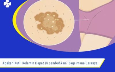 Apakah Kutil Kelamin Dapat Di sembuhkan? Bagaimana Caranya