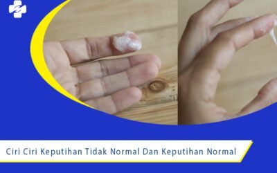 Ciri Ciri Keputihan Tidak Normal Dan Keputihan Normal