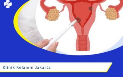 Klinik Kelamin Terpercaya Di Jakarta