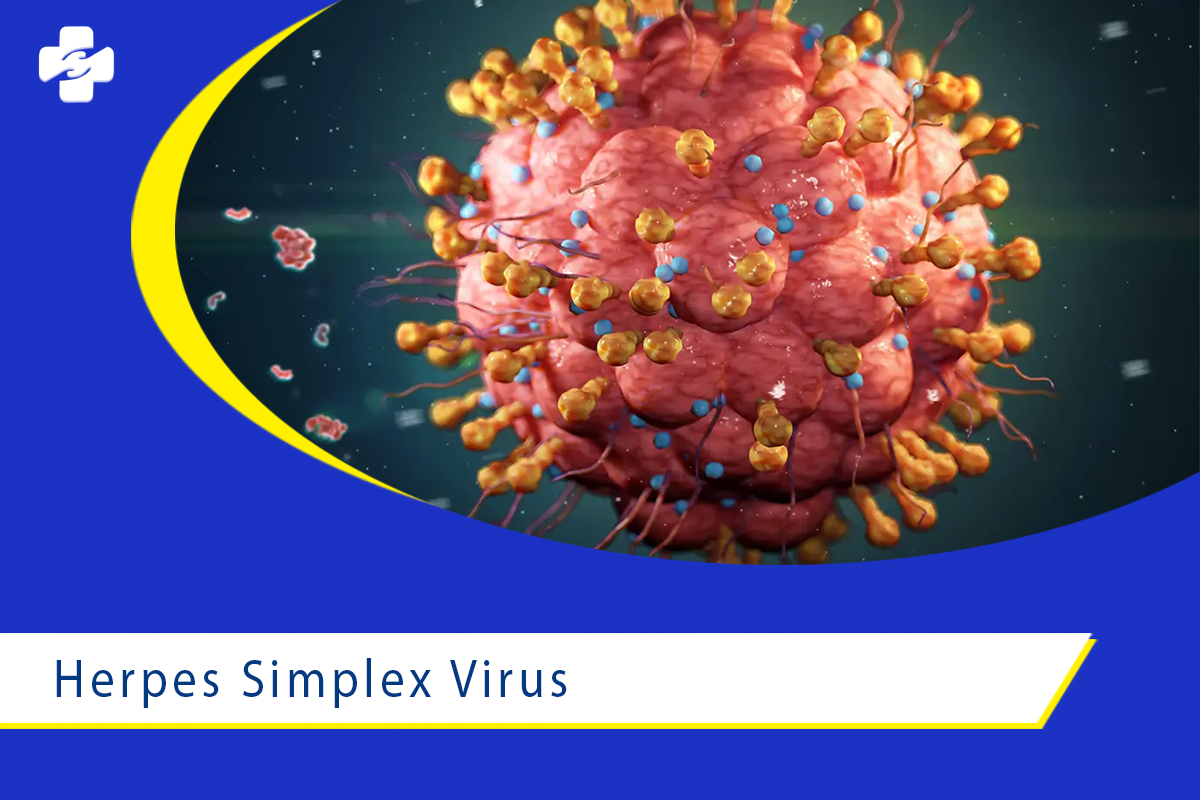 Herpes Simplex virus течение. Вирус симплекс вызывает :. Gobrut вирус.
