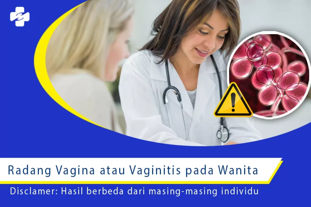 Radang Vagina atau Vaginitis pada Wanita