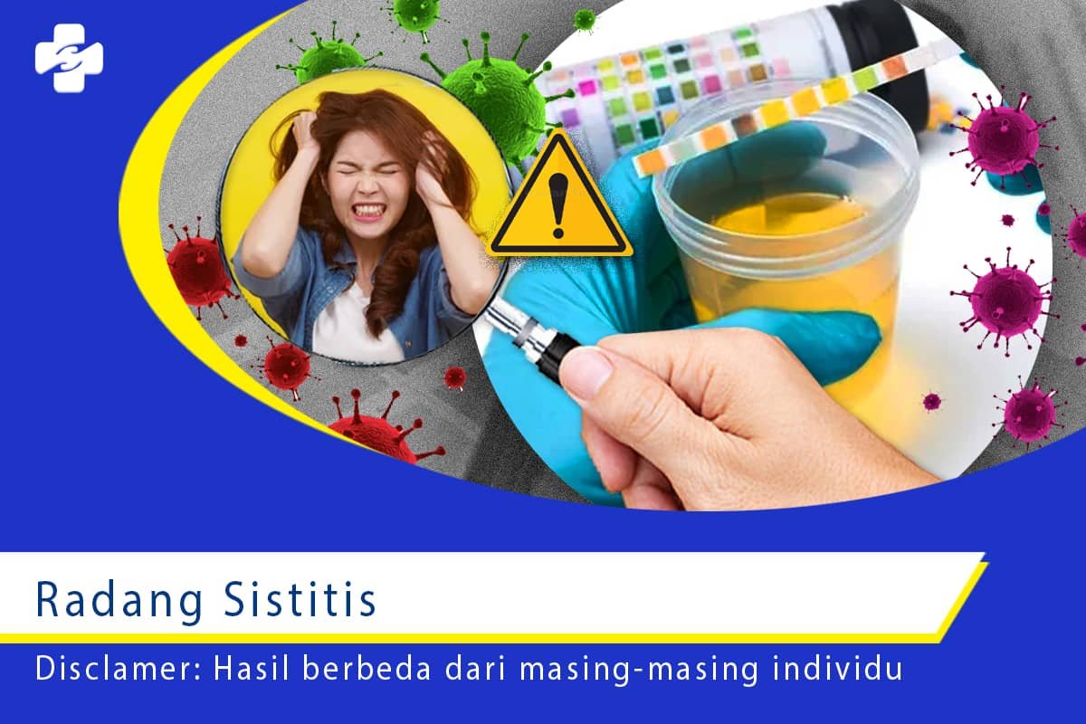 Pengembangan Radang Sistitis Dari Infeksi Bakteri | Klinik Utama Apollo