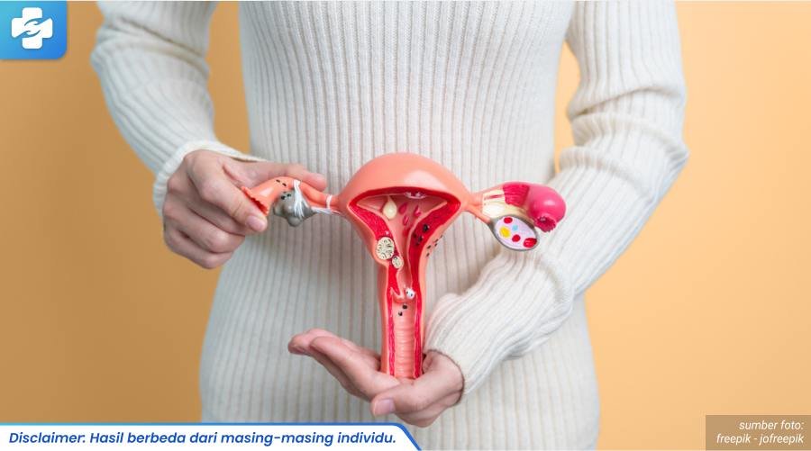 menghilangkan benjolan di vagina 2_4_11zon