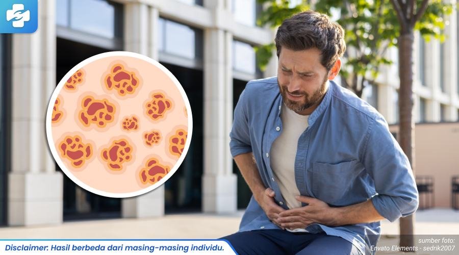 cara mengobati kutil kelamin 1_3_11zon