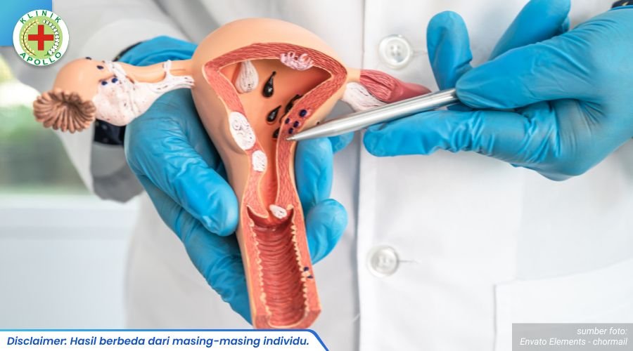 Kelamin Mengeluarkan Nanah 2_6_11zon