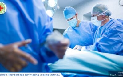 klinik operasi kutil terdekat 1_3_11zon