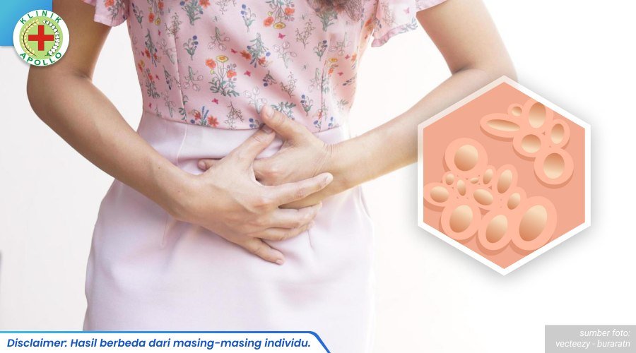 Benjolan Kecil di area intim 2_3_11zon