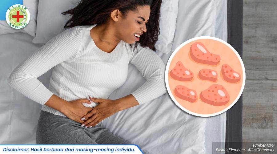 ciri penyakit kelamin 2_1_11zon