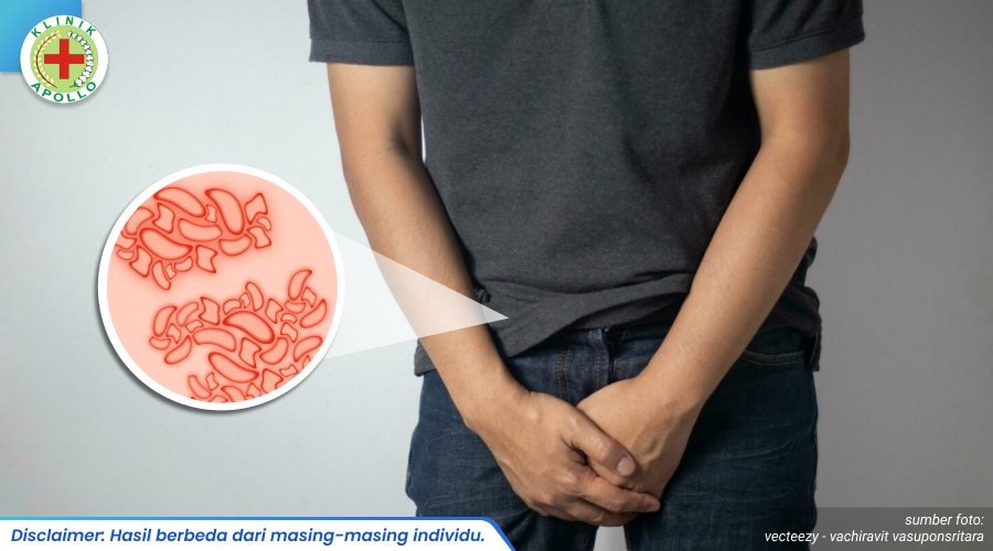 kutil pada kelamin pria 2_3_11zon