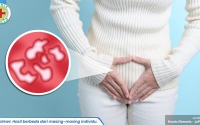 ruam melingkar di selangkangan 1_5_11zon