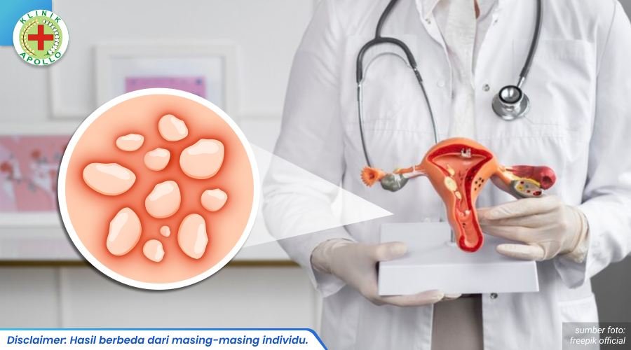 virus herpes genital 2_3_11zon