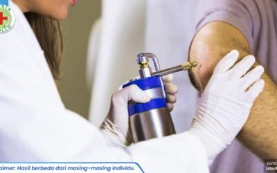 krioterapi kutil kelamin 1_2_11zon