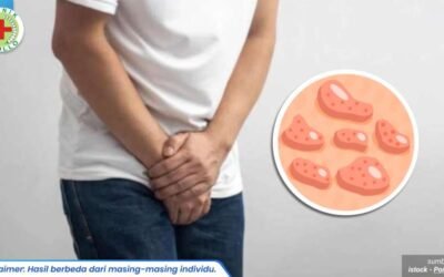 bentol merah di alat kelamin 1_1_11zon