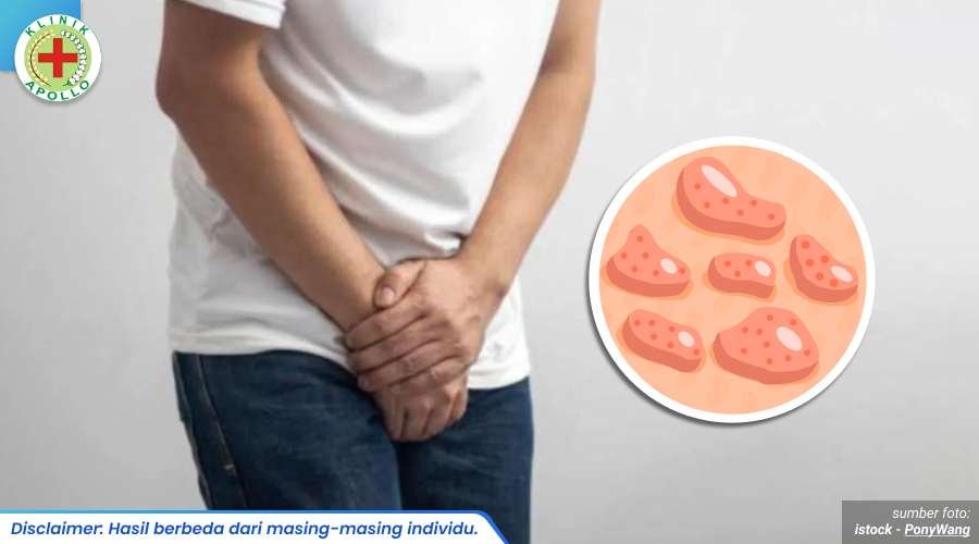 bentol merah di alat kelamin 1_1_11zon