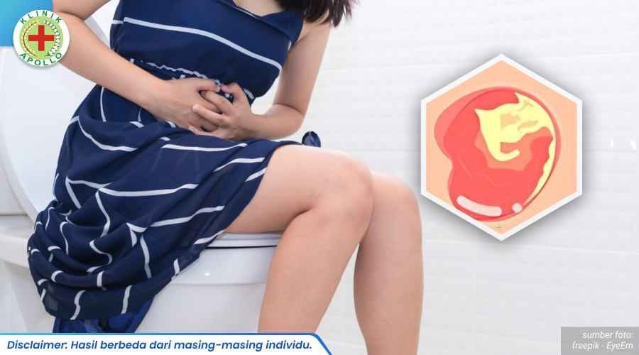 pengobatan infeksi gonroe 2_6_11zon