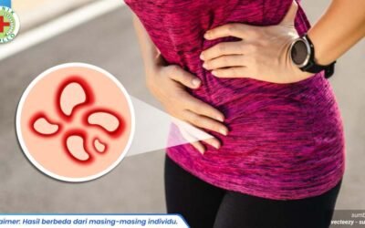 penyakit raja singa 1_5_11zon