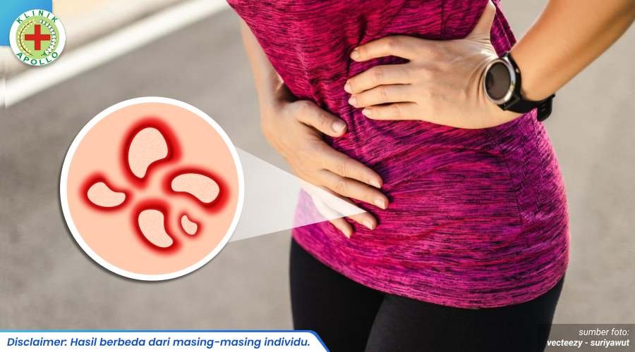 penyakit raja singa 1_5_11zon