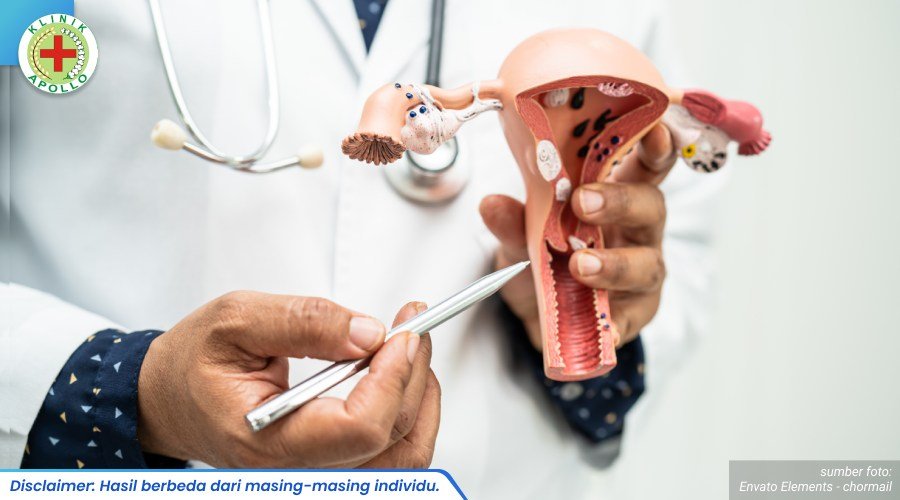 cauter kutil kelamin 2_2_11zon