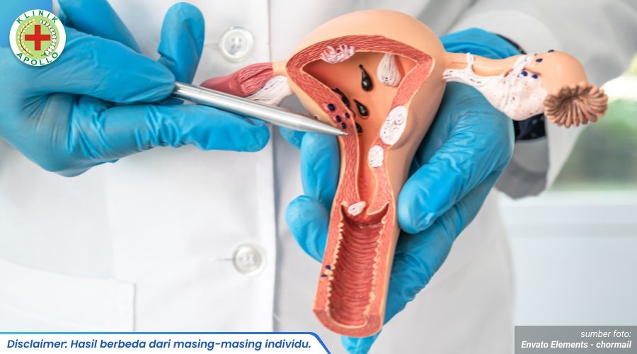 obat vagina gatal 1_3_11zon