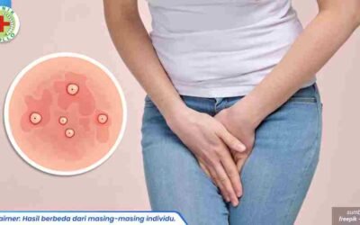 mengatasi vagina gatal 1_1_11zon