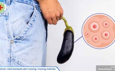 penyebab jerawat di penis 1_3_11zon